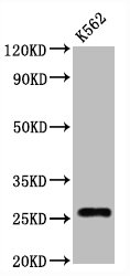Western Blot; Positive WB detected in:K562 whole cell lysate; All lanes:CD81 antibody at 1.25Âµg/ml; Secondary; Goat polyclonal to rabbit IgG at 1/50000 dilution; Predicted band size: 26 KDa; Observed band size: 26 KDa
