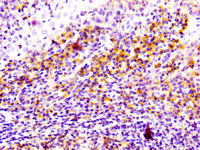 IHC image diluted at 1:100 and staining in paraffin-embedded human tonsil tissue performed on a Leica BondTM system. After dewaxing and hydration, antigen retrieval was mediated by high pressure in a citrate buffer (pH 6.0). Section was blocked with 10% normal goat serum 30min at RT. Then primary antibody (1% BSA) was incubated at 4Â°C overnight. The primary is detected by a biotinylated secondary antibody and visualized using an HRP conjugated SP system.