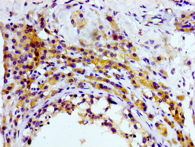 IHC image diluted at 1:100 and staining in paraffin-embedded human testis tissue performed on a Leica BondTM system. After dewaxing and hydration, antigen retrieval was mediated by high pressure in a citrate buffer (pH 6.0). Section was blocked with 10% normal goat serum 30min at RT. Then primary antibody (1% BSA) was incubated at 4Â°C overnight. The primary is detected by a biotinylated secondary antibody and visualized using an HRP conjugated SP system.
