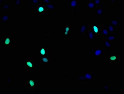 Immunofluorescence staining of Hela cells with RAC07004 at 1:93,counter-stained with DAPI. The cells were fixed in 4% formaldehyde, permeabilized using 0.2% Triton X-100 and blocked in 10% normal Goat Serum. The cells were then incubated with the antibody overnight at 4?.The secondary antibody was Alexa Fluor 488-congugated AffiniPure Goat Anti-Rabbit IgG (H+L).