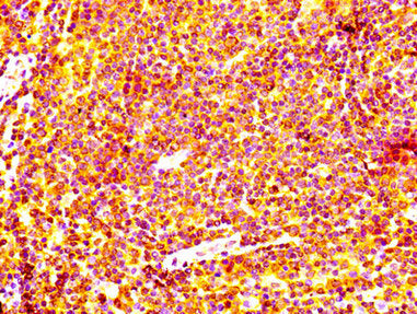 IHC image diluted at 1:100 and staining in paraffin-embedded human lymph node tissue performed on a Leica BondTM system. After dewaxing and hydration, antigen retrieval was mediated by high pressure in a citrate buffer (pH 6.0). Section was blocked with 10% normal goat serum 30min at RT. Then primary antibody (1% BSA) was incubated at 4Â°C overnight. The primary is detected by a biotinylated secondary antibody and visualized using an HRP conjugated SP system.