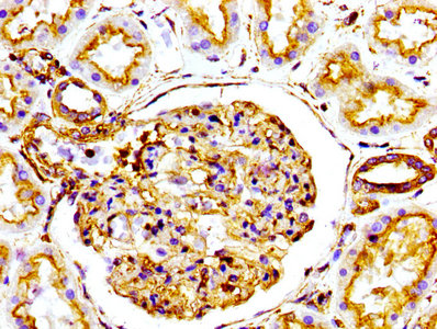 IHC image diluted at 1:100 and staining in paraffin-embedded human kidney tissue performed on a Leica BondTM system. After dewaxing and hydration, antigen retrieval was mediated by high pressure in a citrate buffer (pH 6.0). Section was blocked with 10% normal goat serum 30min at RT. Then primary antibody (1% BSA) was incubated at 4? overnight. The primary is detected by a biotinylated secondary antibody and visualized using an HRP conjugated SP system.
