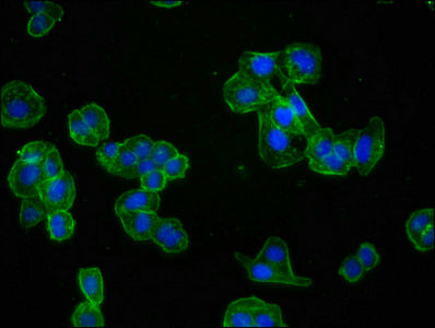 Immunofluorescence staining of HepG2 cells with RAC07006 at 1:60,counter-stained with DAPI. The cells were fixed in 4% formaldehyde, permeabilized using 0.2% Triton X-100 and blocked in 10% normal Goat Serum. The cells were then incubated with the antibody overnight at 4?.The secondary antibody was Alexa Fluor 488-congugated AffiniPure Goat Anti-Rabbit IgG (H+L).