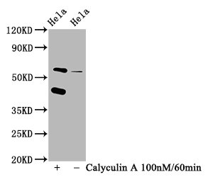 Western Blot; Positive WB detected in Hela whole cell lysate(treated with Calyculin A or not); All lanes Phospho-EIF2AK2 antibody at 1.25Âµg/ml; Secondary; Goat polyclonal to rabbit IgG at 1/50000 dilution; Predicted band size: 62 KDa; Observed band size: 62 KDa;