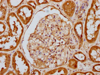 IHC image diluted at 1:100 and staining in paraffin-embedded human kidney tissue performed on a Leica BondTM system. After dewaxing and hydration, antigen retrieval was mediated by high pressure in a citrate buffer (pH 6.0). Section was blocked with 10% normal goat serum 30min at RT. Then primary antibody (1% BSA) was incubated at 4? overnight. The primary is detected by a biotinylated secondary antibody and visualized using an HRP conjugated SP system.