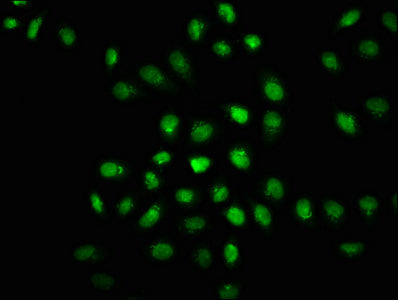 Immunofluorescence staining of Hela cells(treated with 50mM Calyculin A for 30min) with RAC07007 at 1:100,counter-stained with DAPI. The cells were fixed in 4% formaldehyde, permeabilized using 0.2% Triton X-100 and blocked in 10% normal Goat Serum. The cells were then incubated with the antibody overnight at 4?. The secondary antibody was Alexa Fluor 488-congugated AffiniPure Goat Anti-Rabbit IgG (H+L).