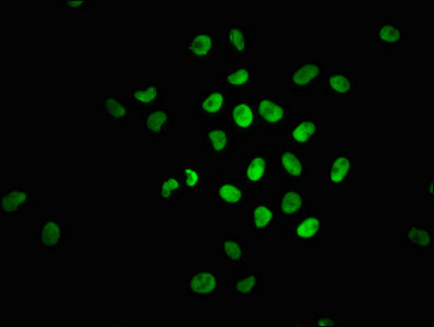Immunofluorescence staining of Hela cells with RAC07008 at 1:100,counter-stained with DAPI. The cells were fixed in 4% formaldehyde, permeabilized using 0.2% Triton X-100 and blocked in 10% normal Goat Serum. The cells were then incubated with the antibody overnight at 4?. The secondary antibody was Alexa Fluor 488-congugated AffiniPure Goat Anti-Rabbit IgG (H+L).
