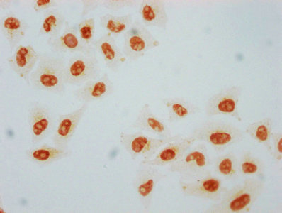 Immunocytochemistry analysis diluted at 1:80 and staining in Hela cells performed on a Leica BondTM system. The cells were fixed in 4% formaldehyde, permeabilized using 0.2% Triton X-100 and blocked with 10% normal goat serum 30min at RT. Then primary antibody (1% BSA) was incubated at 4? overnight. The primary is detected by a biotinylated secondary antibody and visualized using an HRP conjugated SP system.