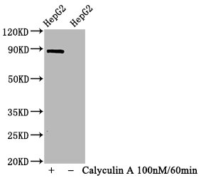 Western Blot; Positive WB detected in HepG2 whole cell lysate(treated with Calyculin A or not); All lanes Phospho-STAT1 antibody at 1.065Âµg/ml; Secondary; Goat polyclonal to rabbit IgG at 1/50000 dilution; Predicted band size: 87 KDa; Observed band size: 87 KDa;