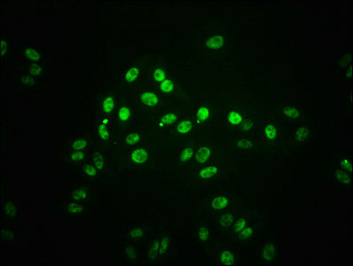 Immunofluorescence staining of HepG2 cells(treated with 100mM Calyculin A for 30min) with RAC07010 at 1:66,counter-stained with DAPI. The cells were fixed in 4% formaldehyde, permeabilized using 0.2% Triton X-100 and blocked in 10% normal Goat Serum. The cells were then incubated with the antibody overnight at 4?. The secondary antibody was Alexa Fluor 488-congugated AffiniPure Goat Anti-Rabbit IgG (H+L).