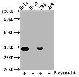 Western Blot; Positive WB detected in:Hela whole cell lysate, 293 whole cell lysate(treated with Pervanadate or not); All lanes:Phospho-CDK2 antibody at 0.8Âµg/ml; Secondary; Goat polyclonal to rabbit IgG at 1/50000 dilution; Predicted band size: 34 KDa; Observed band size: 34 KDa;