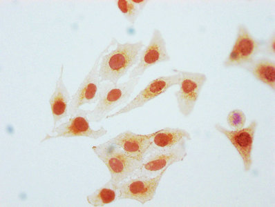 Immunocytochemistry analysis diluted at 1:80 and staining in Hela cells(treated with Pervanadate) performed on a Leica BondTM system. The cells were fixed in 4% formaldehyde, permeabilized using 0.2% Triton X-100 and blocked with 10% normal goat serum 30min at RT. Then primary antibody (1% BSA) was incubated at 4? overnight. The primary is detected by a biotinylated secondary antibody and visualized using an HRP conjugated SP system.