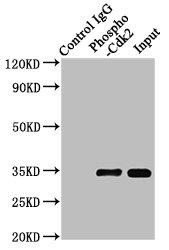 Immunoprecipitating Phospho-CDK2 in Hela whole cell lysate treated with Pervanadate; Lane 1: Rabbit control IgG(1Âµg)instead in Hela whole cell lysate treated with Pervanadate.For western blotting,a HRP-conjugated Protein G antibody was used as the secondary antibody (1/2000); Lane 2: RAC07011(3Âµg)+ Hela whole cell lysate treated with Pervanadate(1mg); Lane 3: Hela whole cell lysate treated with Pervanadate(20Âµg);