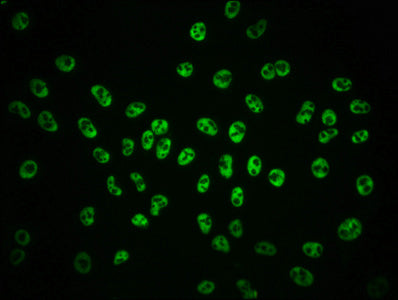 Immunofluorescence staining of Hela cells with RAC07012 at 1:100,counter-stained with DAPI. The cells were fixed in 4% formaldehyde, permeabilized using 0.2% Triton X-100 and blocked in 10% normal Goat Serum. The cells were then incubated with the antibody overnight at 4?. The secondary antibody was Alexa Fluor 488-congugated AffiniPure Goat Anti-Rabbit IgG (H+L).