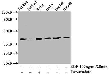 Western Blot; Positive WB detected in:Jurkat whole cell lysate, Hela whole cell lysate, HepG2 whole cell lysate(treated with EGF or Pervanadate); All lanes: Phospho-LAT antibody at 2.9Âµg/ml; Secondary; Goat polyclonal to rabbit IgG at 1/50000 dilution; Predicted band size: 38 KDa; Observed band size: 38 KDa