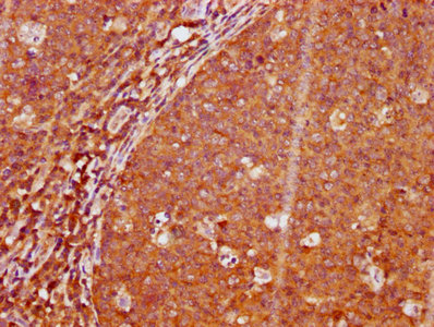 IHC image diluted at 1:100 and staining in paraffin-embedded human tonsil tissue performed on a Leica BondTM system. After dewaxing and hydration, antigen retrieval was mediated by high pressure in a citrate buffer (pH 6.0). Section was blocked with 10% normal goat serum 30min at RT. Then primary antibody (1% BSA) was incubated at 4Â°C overnight. The primary is detected by a biotinylated secondary antibody and visualized using an HRP conjugated SP system.
