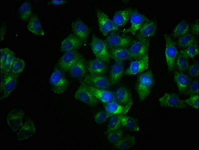 Immunofluorescence staining of Hela cells with RAC07013 at 1:100,counter-stained with DAPI. The cells were fixed in 4% formaldehyde, permeabilized using 0.2% Triton X-100 and blocked in 10% normal Goat Serum. The cells were then incubated with the antibody overnight at 4Â°C. The secondary antibody was Alexa Fluor 488-congugated AffiniPure Goat Anti-Rabbit IgG (H+L).