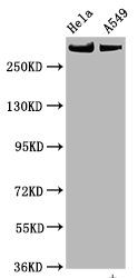 Western Blot; Positive WB detected in Hela whole cell lysate,A549 whole cell lysate; All lanes Phospho-MTOR antibody at 0.825Âµg/ml; Secondary; Goat polyclonal to rabbit IgG at 1/50000 dilution; Predicted band size: 289 KDa; Observed band size: 289 KDa;