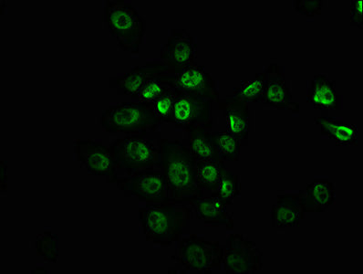 Immunofluorescence staining of Hela cells with RAC07014 at 1:100,counter-stained with DAPI. The cells were fixed in 4% formaldehyde, permeabilized using 0.2% Triton X-100 and blocked in 10% normal Goat Serum. The cells were then incubated with the antibody overnight at 4?. The secondary antibody was Alexa Fluor 488-congugated AffiniPure Goat Anti-Rabbit IgG (H+L).