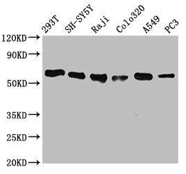 Western Blot; Positive WB detected in: 293T whole cell lysate, SH-SY5Y whole cell lysate, Raji whole cell lysate, Colo320 whole cell lysate, A549 whole cell lysate, PC3 whole cell lysate; All lanes: FTO antibody at 0.7Âµg/ml; Secondary; Goat polyclonal to rabbit IgG at 1/50000 dilution; Predicted band size: 59, 15, 7, 13 KDa; Observed band size: 59 KDa;