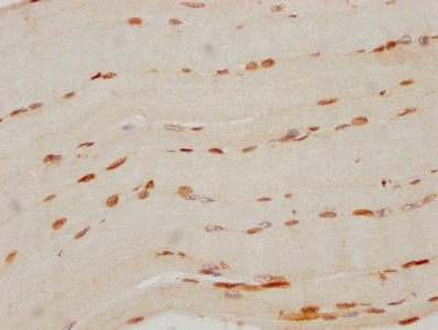 IHC image diluted at 1:70 and staining in paraffin-embedded human skeletal muscle tissue performed on a Leica BondTM system. After dewaxing and hydration, antigen retrieval was mediated by high pressure in a citrate buffer (pH 6.0). Section was blocked with 10% normal goat serum 30min at RT. Then primary antibody (1% BSA) was incubated at 4? overnight. The primary is detected by a biotinylated secondary antibody and visualized using an HRP conjugated SP system.