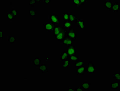 Immunofluorescence staining of Hela cells with RAC07015 at 1:23, counter-stained with DAPI. The cells were fixed in 4% formaldehyde, permeabilized using 0.2% Triton X-100 and blocked in 10% normal Goat Serum. The cells were then incubated with the antibody overnight at 4?. The secondary antibody was Alexa Fluor 488-congugated AffiniPure Goat Anti-Rabbit IgG (H+L).
