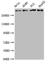 Western Blot; Positive WB detected in: Hela whole cell lysate, A549 whole cell lysate, PC3 whole cell lysate, HepG2 whole cell lysate; All lanes: ATM antibody at 2.05Âµg/ml; Secondary; Goat polyclonal to rabbit IgG at 1/50000 dilution; Predicted band size: 350 KDa; Observed band size: 350 KDa;