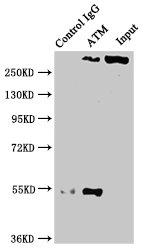 Immunoprecipitating ATM in PC3 whole cell lysate; , Lane 1: Rabbit control IgG instead in PC3 whole cell lysate., For western blotting, a HRP-conjugated Protein G antibody was used as the secondary antibody (1/2000); , Lane 2: RAC07016 (3Âµg) + PC3 whole cell lysate (500Âµg); , Lane 3: PC3 whole cell lysate (20Âµg);