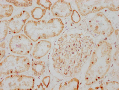 IHC image diluted at 1:107.5 and staining in paraffin-embedded human kidney tissue performed on a Leica BondTM system. After dewaxing and hydration, antigen retrieval was mediated by high pressure in a citrate buffer (pH 6.0). Section was blocked with 10% normal goat serum 30min at RT. Then primary antibody (1% BSA) was incubated at 4? overnight. The primary is detected by a biotinylated secondary antibody and visualized using an HRP conjugated SP system.