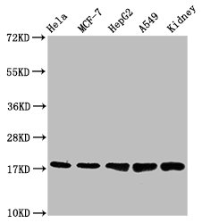 Western Blot; Positive WB detected in: Hela whole cell lysate, MCF-7 whole cell lysate, HepG2 whole cell lysate, A549 whole cell lysate, Mouse kidney tissue; All lanes: PBR antibody at 1.2Âµg/ml; Secondary; Goat polyclonal to rabbit IgG at 1/50000 dilution; Predicted band size: 19, 11 KDa; Observed band size: 19 KDa;