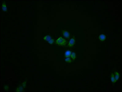 Immunofluorescence staining of PC3 cells with RAC07018 at 1:39, counter-stained with DAPI. The cells were fixed in 4% formaldehyde, permeabilized using 0.2% Triton X-100 and blocked in 10% normal Goat Serum. The cells were then incubated with the antibody overnight at 4?. The secondary antibody was Alexa Fluor 488-congugated AffiniPure Goat Anti-Rabbit IgG (H+L).