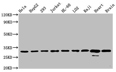 Western Blot; Positive WB detected in: Hela whole cell lysate, HepG2 whole cell lysate, 293 whole cell lysate, Jurkat whole cell lysate, HL-60 whole cell lysate, LO2 whole cell lysate, Raji whole cell lysate, Rat heart tissue, Mouse brain tissue; All lanes: VDAC1 antibody at 0.7Âµg/ml; Secondary; Goat polyclonal to rabbit IgG at 1/50000 dilution; Predicted band size: 31 KDa; Observed band size: 31 KDa;