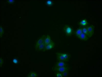 Immunofluorescence staining of HepG2 cells with RAC07020 at 1:53, counter-stained with DAPI. The cells were fixed in 4% formaldehyde, permeabilized using 0.2% Triton X-100 and blocked in 10% normal Goat Serum. The cells were then incubated with the antibody overnight at 4?. The secondary antibody was Alexa Fluor 488-congugated AffiniPure Goat Anti-Rabbit IgG (H+L).
