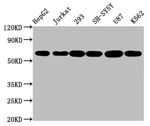Western Blot; Positive WB detected in: HepG2 whole cell lysate, Jurkat whole cell lysate, 293 whole cell lysate, SH-SY5Y whole cell lysate, U87 whole cell lysate, K562 whole cell lysate; All lanes: CYP19A1 antibody at 2.3Âµg/ml; Secondary; Goat polyclonal to rabbit IgG at 1/50000 dilution; Predicted band size: 58, 25 KDa; Observed band size: 58 KDa;