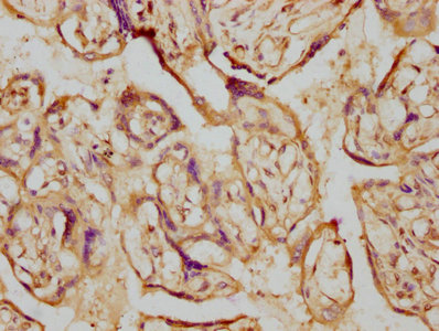 IHC image diluted at 1:230 and staining in paraffin-embedded human placenta tissue performed on a Leica BondTM system. After dewaxing and hydration, antigen retrieval was mediated by high pressure in a citrate buffer (pH 6.0). Section was blocked with 10% normal goat serum 30min at RT. Then primary antibody (1% BSA) was incubated at 4? overnight. The primary is detected by a biotinylated secondary antibody and visualized using an HRP conjugated SP system.
