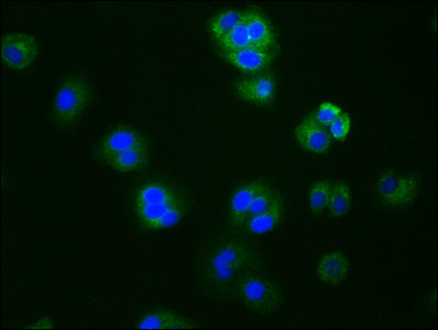 Immunofluorescence staining of HepG2 cells with RAC07021 at 1:76, counter-stained with DAPI. The cells were fixed in 4% formaldehyde, permeabilized using 0.2% Triton X-100 and blocked in 10% normal Goat Serum. The cells were then incubated with the antibody overnight at 4?. The secondary antibody was Alexa Fluor 488-congugated AffiniPure Goat Anti-Rabbit IgG (H+L).