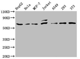 Western Blot; Positive WB detected in: HepG2 whole cell lysate, Hela whole cell lysate, MCF-7 whole cell lysate, Jurkat whole cell lysate, A549 whole cell lysate, 293 whole cell lysate, NIH/3T3 whole cell lysate; All lanes: c-FOS antibody at 0.81Âµg/ml; Secondary; Goat polyclonal to rabbit IgG at 1/50000 dilution; Predicted band size: 41, 29, 37 KDa; Observed band size: 62 KDa;