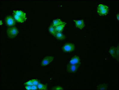 Immunofluorescence staining of HepG2 cells with RAC07022 at 1:27, counter-stained with DAPI. The cells were fixed in 4% formaldehyde, permeabilized using 0.2% Triton X-100 and blocked in 10% normal Goat Serum. The cells were then incubated with the antibody overnight at 4?. The secondary antibody was Alexa Fluor 488-congugated AffiniPure Goat Anti-Rabbit IgG (H+L).