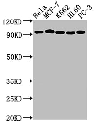 Western Blot; Positive WB detected in: Hela whole cell lysate, MCF-7 whole cell lysate, K562 whole cell lysate, HL60 whole cell lysate, PC-3 whole cell lysate; All lanes: TOP1 antibody at 1:2000; Secondary; Goat polyclonal to rabbit IgG at 1/50000 dilution; Predicted band size: 91 kDa; Observed band size: 91 kDa;