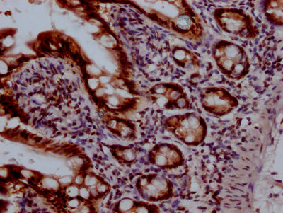IHC image diluted at 1:100 and staining in paraffin-embedded human small intestine tissue performed on a Leica BondTM system. After dewaxing and hydration, antigen retrieval was mediated by high pressure in a citrate buffer (pH 6.0). Section was blocked with 10% normal goat serum 30min at RT. Then primary antibody (1% BSA) was incubated at 4? overnight. The primary is detected by a Goat anti-rabbit IgG polymer labeled by HRP and visualized using 0.05% DAB.