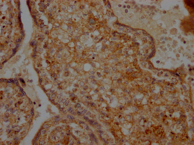 IHC image diluted at 1:100 and staining in paraffin-embedded human placenta tissue performed on a Leica BondTM system. After dewaxing and hydration, antigen retrieval was mediated by high pressure in a citrate buffer (pH 6.0). Section was blocked with 10% normal goat serum 30min at RT. Then primary antibody (1% BSA) was incubated at 4? overnight. The primary is detected by a Goat anti-rabbit IgG polymer labeled by HRP and visualized using 0.05% DAB.