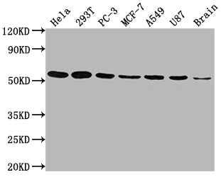 Western Blot; Positive WB detected in: Hela whole cell lysate, 293T whole cell lysate, PC-3 whole cell lysate, MCF-7 whole cell lysate, A549 whole cell lysate, U87 whole cell lysate, Brain tissue; All lanes: KLF4 antibody at 1:1500; Secondary; Goat polyclonal to rabbit IgG at 1/50000 dilution; Predicted band size: 55, 52, 46, 13, 7 kDa; Observed band size: 55 kDa;