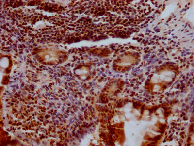 IHC image diluted at 1:100 and staining in paraffin-embedded human small intestine tissue performed on a Leica BondTM system. After dewaxing and hydration, antigen retrieval was mediated by high pressure in a citrate buffer (pH 6.0). Section was blocked with 10% normal goat serum 30min at RT. Then primary antibody (1% BSA) was incubated at 4? overnight. The primary is detected by a Goat anti-rabbit IgG polymer labeled by HRP and visualized using 0.05% DAB.