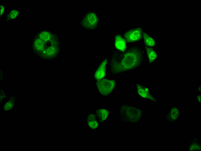 Immunofluorescence staining of Hela Cells with RAC07025 at 1:50, counter-stained with DAPI. The cells were fixed in 4% formaldehyde, permeated by 0.2% TritonX-100, and blocked in 10% normal Goat Serum. The cells were then incubated with the antibody overnight at 4?. Nuclear DNA was labeled in blue with DAPI. The secondary antibody was FITC-conjugated AffiniPure Goat Anti-Rabbit IgG (H+L).