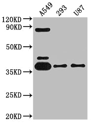 Western Blot; Positive WB detected in: A549 whole cell lysate, 293 whole cell lysate, U87 whole cell lysate; All lanes: ADORA1 antibody at 1:2000; Secondary; Goat polyclonal to rabbit IgG at 1/50000 dilution; Predicted band size: 37, 14 kDa; Observed band size: 37 kDa;