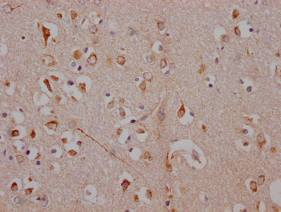 IHC image diluted at 1:100 and staining in paraffin-embedded human brain tissue performed on a Leica BondTM system. After dewaxing and hydration, antigen retrieval was mediated by high pressure in a citrate buffer (pH 6.0). Section was blocked with 10% normal goat serum 30min at RT. Then primary antibody (1% BSA) was incubated at 4? overnight. The primary is detected by a Goat anti-rabbit IgG polymer labeled by HRP and visualized using 0.05% DAB.