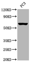 Western Blot; Positive WB detected in:PC3 whole cell lysate; All lanes: Muscarinic Acetylcholine Receptor M3 antibody at 1:2000; Secondary; Goat polyclonal to rabbit IgG at 1/50000 dilution; Predicted band size: 67 kDa; Observed band size: 67 kDa;
