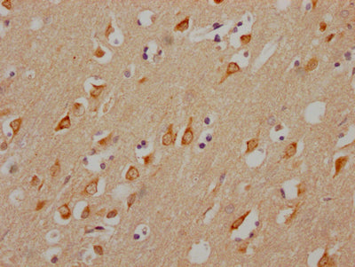 IHC image diluted at 1:100 and staining in paraffin-embedded human brain tissue performed on a Leica BondTM system. After dewaxing and hydration, antigen retrieval was mediated by high pressure in a citrate buffer (pH 6.0). Section was blocked with 10% normal goat serum 30min at RT. Then primary antibody (1% BSA) was incubated at 4? overnight. The primary is detected by a Goat anti-rabbit IgG polymer labeled by HRP and visualized using 0.05% DAB.