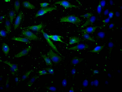 Immunofluorescence staining of Hela Cells with RAC07028 at 1:50, counter-stained with DAPI. The cells were fixed in 4% formaldehyde, permeated by 0.2% TritonX-100, and blocked in 10% normal Goat Serum. The cells were then incubated with the antibody overnight at 4?. Nuclear DNA was labeled in blue with DAPI. The secondary antibody was FITC-conjugated AffiniPure Goat Anti-Rabbit IgG (H+L).