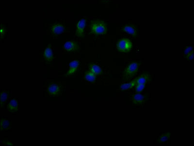 Immunofluorescence staining of MCF7 Cells with RAC07029 at 1:50, counter-stained with DAPI. The cells were fixed in 4% formaldehyde, permeated by 0.2% TritonX-100, and blocked in 10% normal Goat Serum. The cells were then incubated with the antibody overnight at 4?. Nuclear DNA was labeled in blue with DAPI. The secondary antibody was FITC-conjugated AffiniPure Goat Anti-Rabbit IgG (H+L).